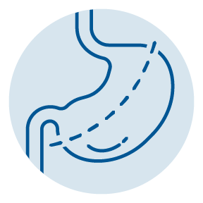 lap band icon | bariatric surgery