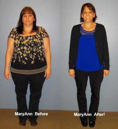MaryAnn before and after photo showing weight loss