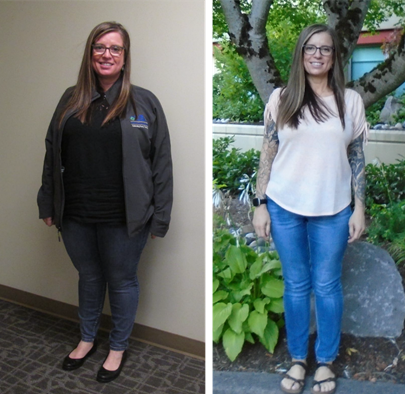 Kellie, a patient of weight loss for life, in a before and after photo.