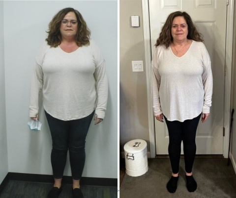 Jo poses in a before and after photo