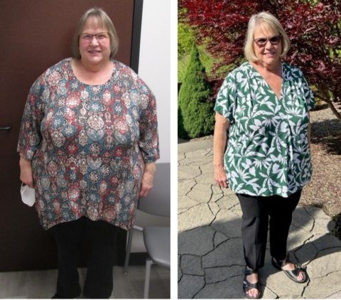 Sonya - Weight Loss For Life Before & After Photos