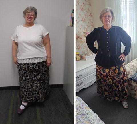 Sharon Before & After Weight Loss 