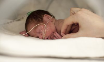A newborn baby with tubes attached to their face is treated by a health care worker