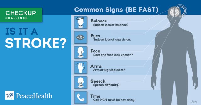 Commons symptoms of a stroke - BE FAST