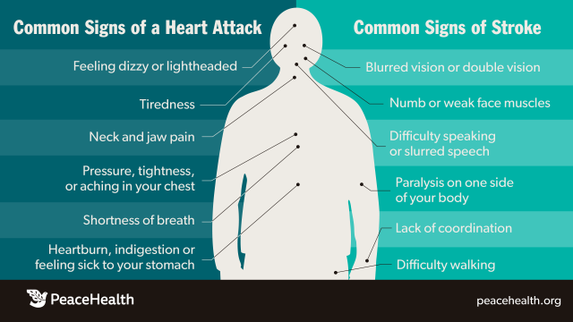 Common signs of heart attack and stroke